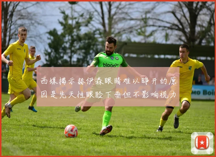 西媒揭示赫伊森眼睛难以睁开的原因是先天性眼睑下垂但不影响视力